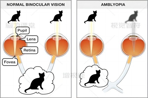 个性化“数字疗法”：有助于提升“积极性”和“效果”